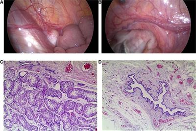 Case Report: De novo variant in myelin regulatory factor in a Chinese child with 46,XY disorder/difference of sex development, cardiac and urogenital anomalies, and short stature